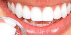 Gum Disease Treatment Irondequoit, NY - serving the Rochester, NY region