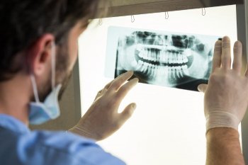 dental implants rochester ny